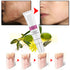 RtopR Facial Body Scar Removal Cream Repair Skin