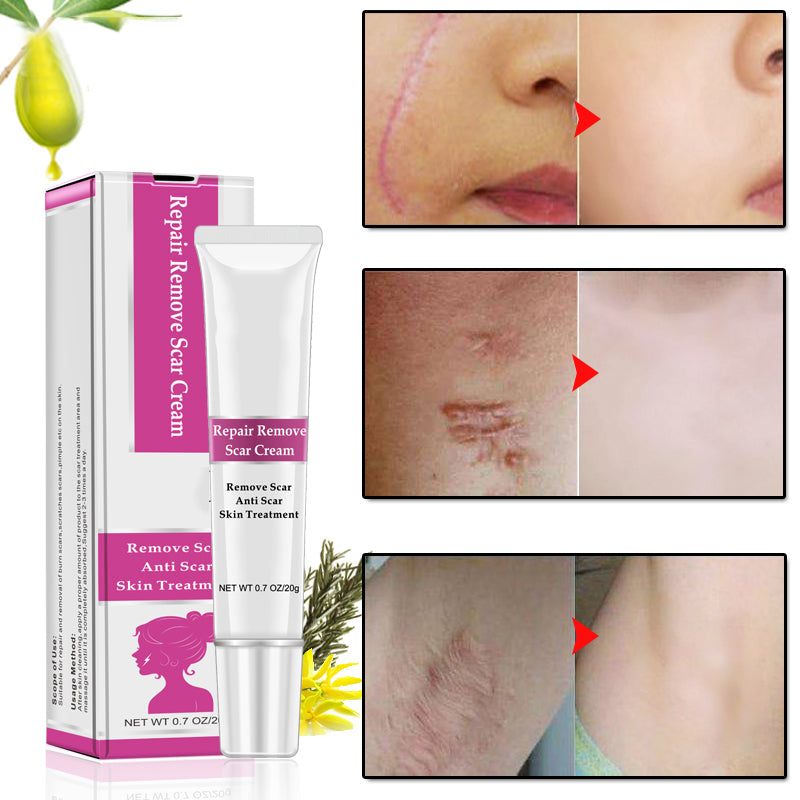 RtopR Facial Body Scar Removal Cream Repair Skin